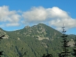 Spark Plug Mtn